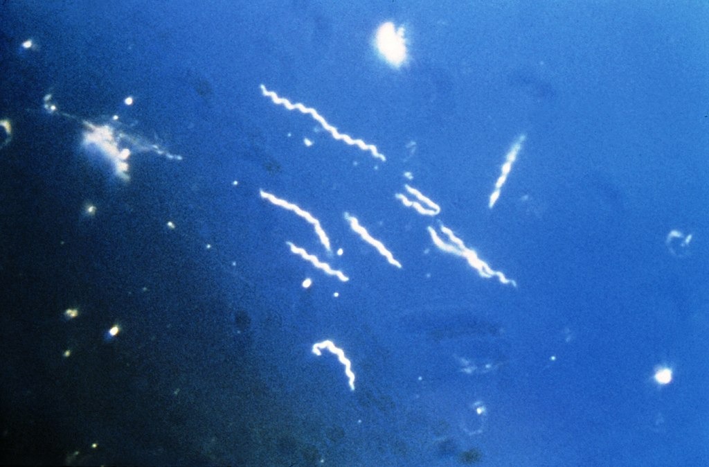 Borrelia burgdorferi, бактериальный агент, вызывающий болезнь Лайма. Фото: Centers for Disease Control and Prevention's / Public Health Image Library