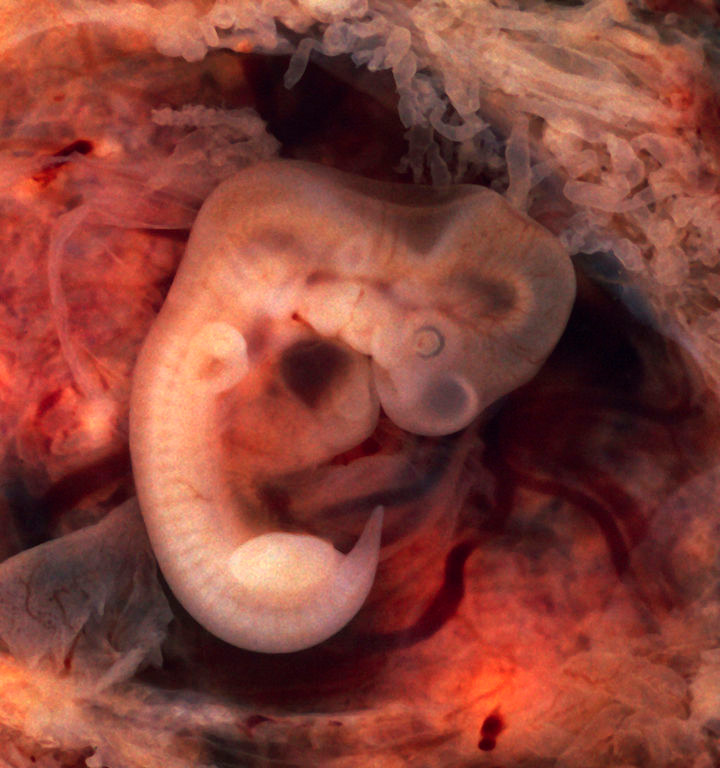 Месячный эмбрион. Фото: общественное достояние
