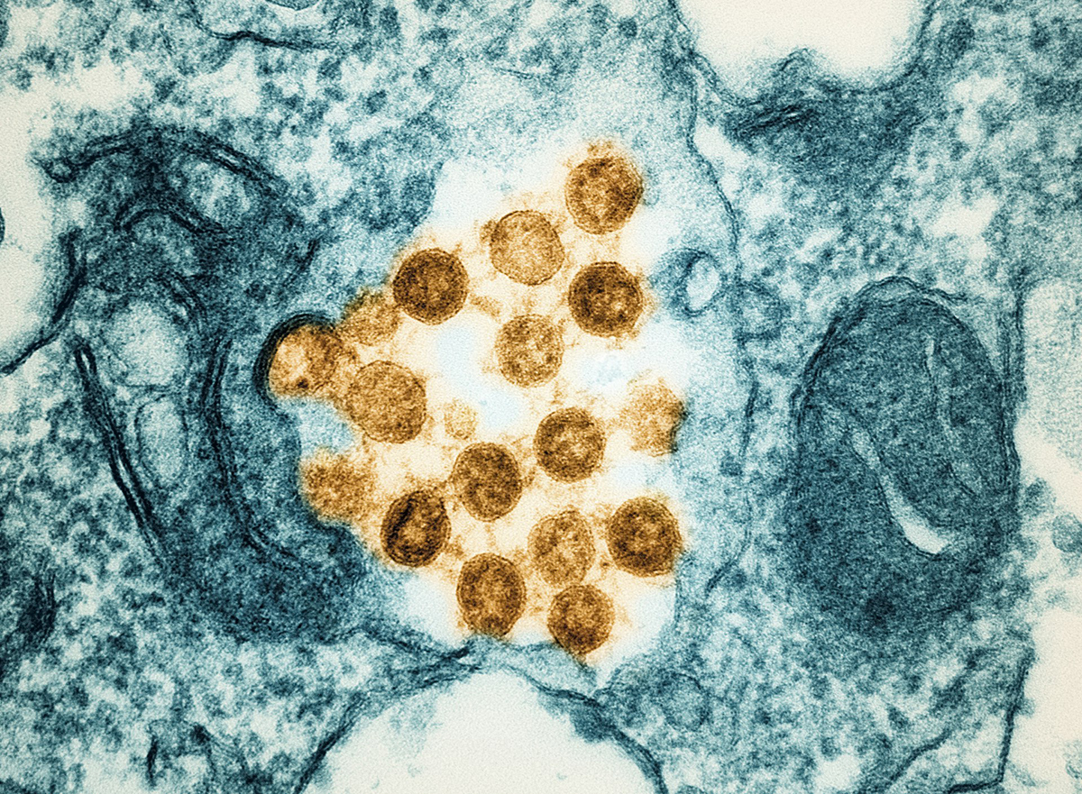 коронавирус SARS-CoV-2 (Омикрон). Фото: National Institute of Allergy and Infectious Diseases / Unsplash