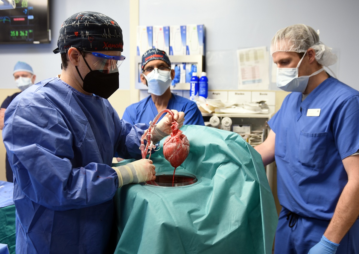 Пересадка свиного сердца в 2022 году. Фото:&nbsp;University of Maryland School of Medicine