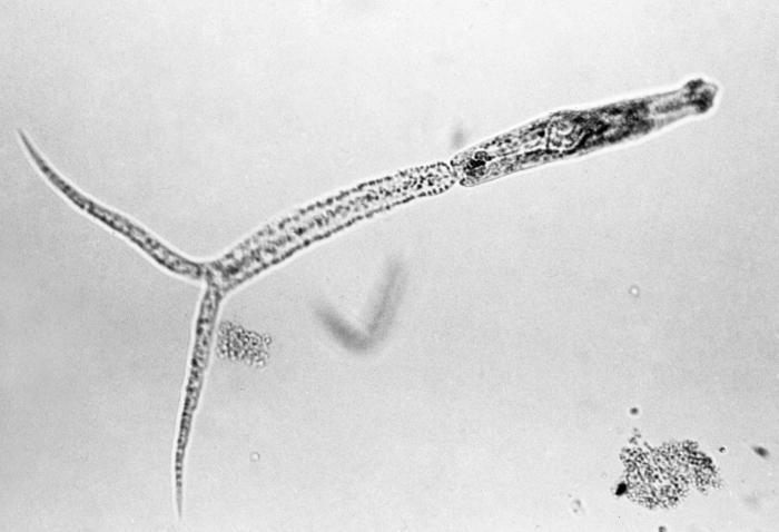 Церкарий трематод рода <em>Trichobilharzia</em>. Фото: CDC/ Minnesota Department of Health, R.N. Barr Library