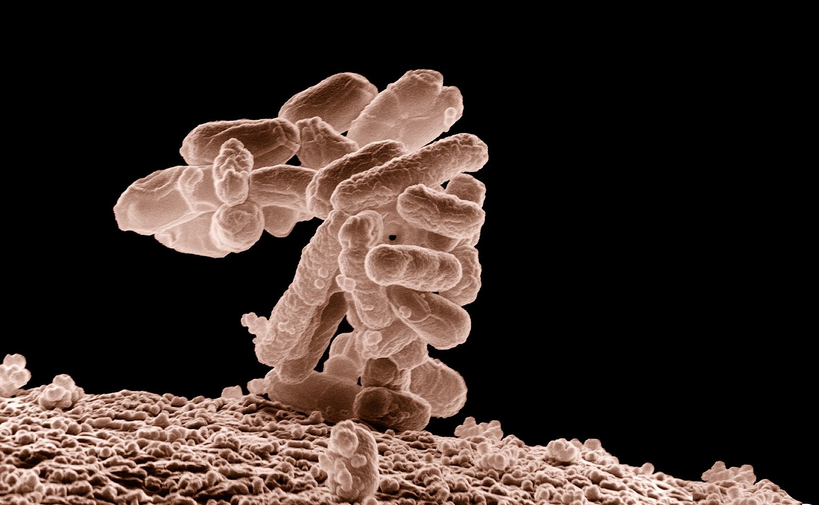 Бактерии E. coli. Фото: Eric Erbe, digital colorization by Christopher Pooley, both of USDA, ARS, EMU